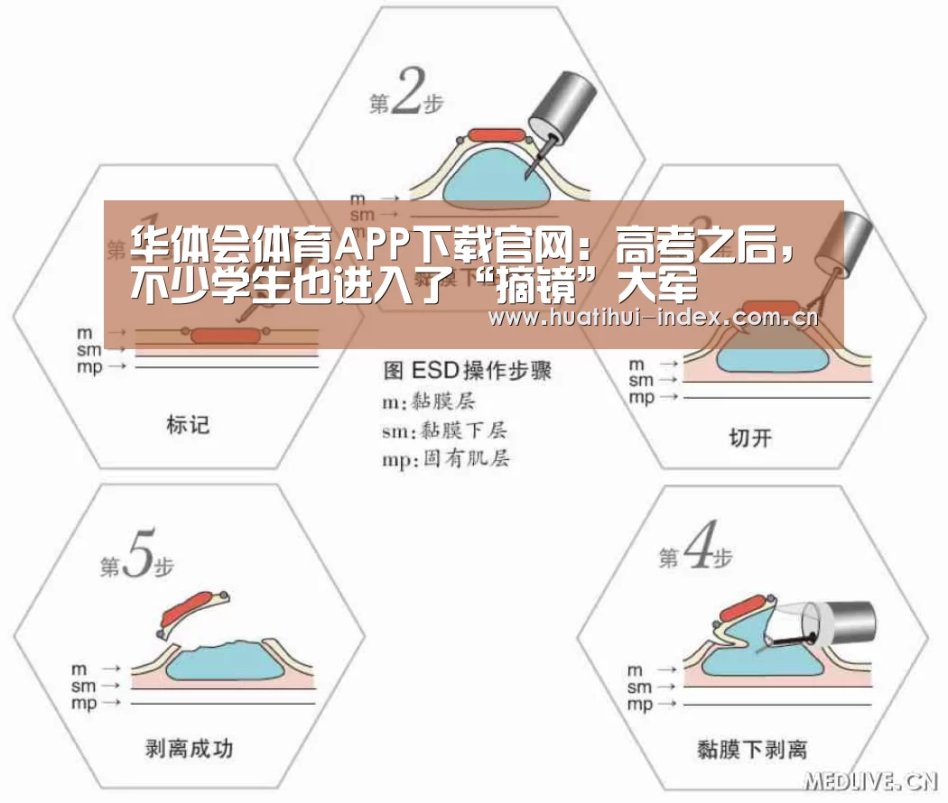 华体会体育APP下载官网:高考之后,不少学生也进入了“摘镜”大军(图2) 华体会体育APP下载官网